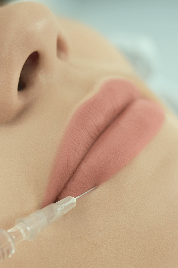 Hacimli dudak dolgusu